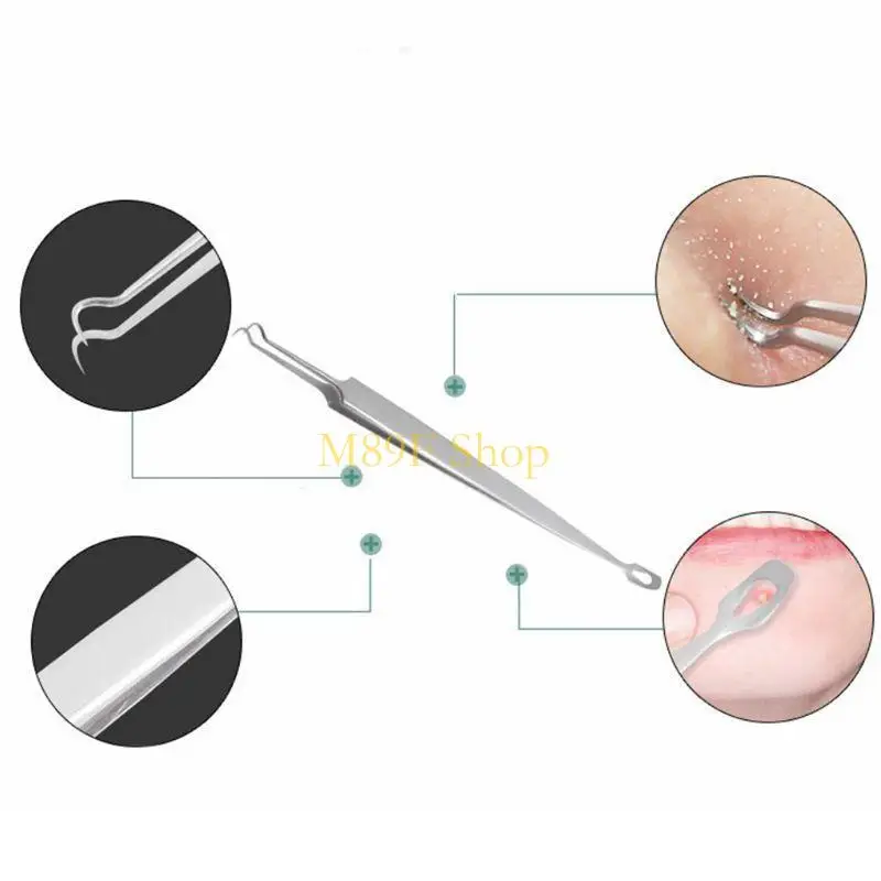 M89F สแตนเลสสตีลปลายสองส่วนโค้งมัดหัวดำแหนบแหนบเข็มสิวสิว Comedone BLEMISH EXTRACTOR TOOL