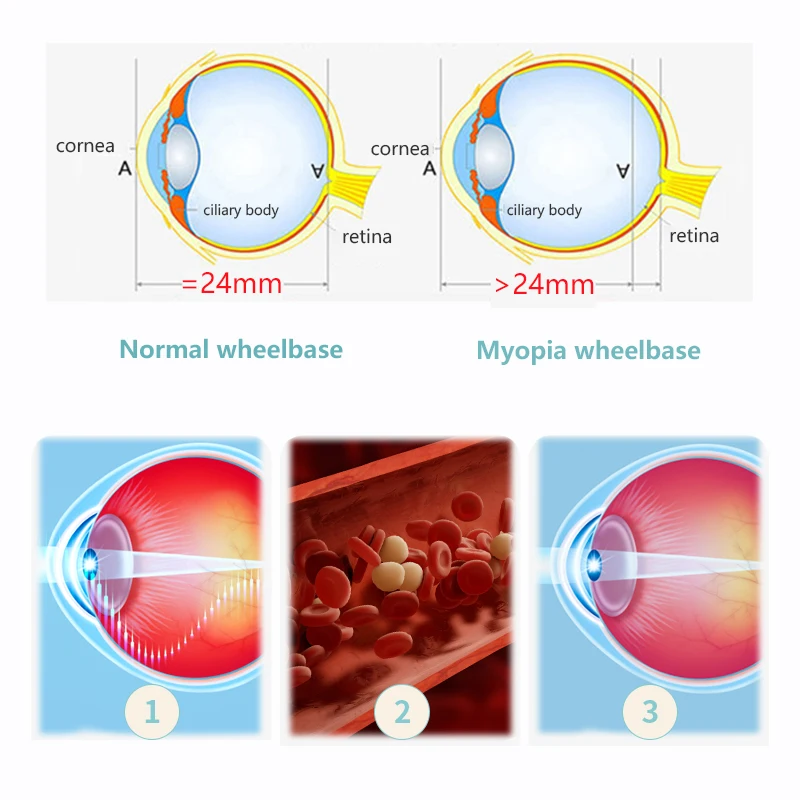 Nueva herramienta profesional de masaje ocular Ems para máquina electrónica de masaje ocular, cuidado relajante de presión ocular con vibración