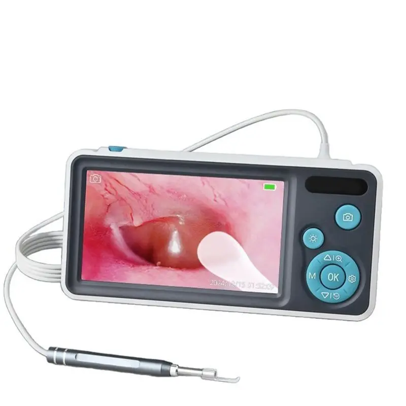 【CYBER MONDAY】Digital Ear Camera Otoscope With 1080P IPS Screen For Kids Home Ear Inspection Cleaning Cleaner
