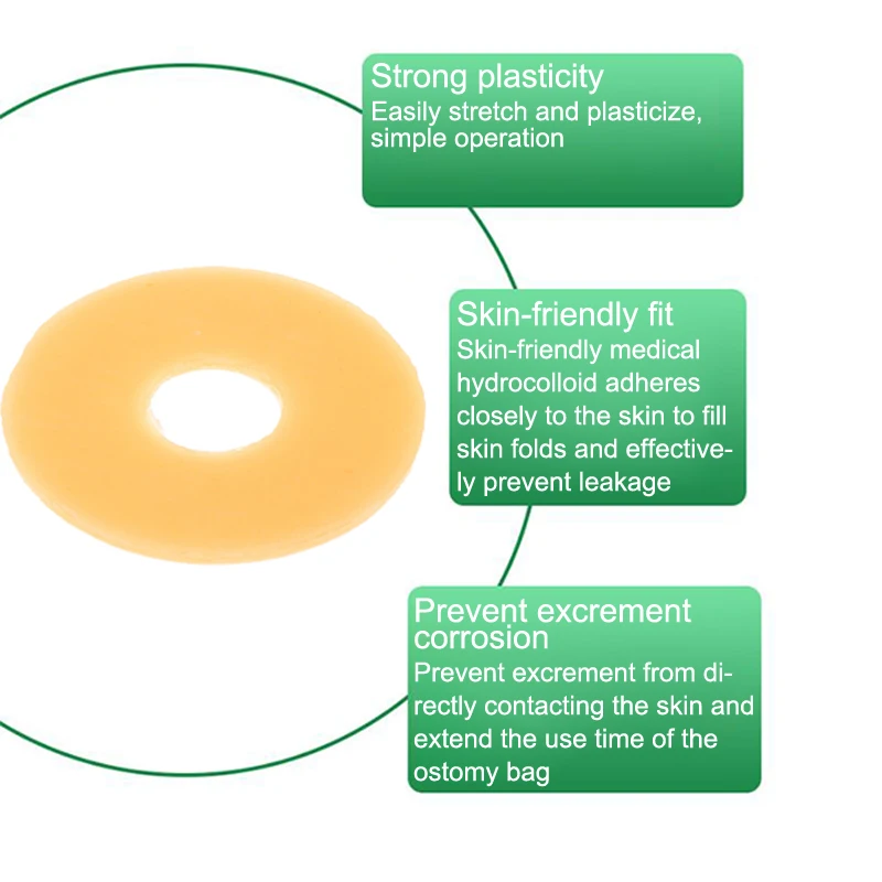 10Pc Anti-Leakage Ring For Colostomy Bag Ostomy Paste Ring Baseplates Stoma Care Products To Protect Skin
