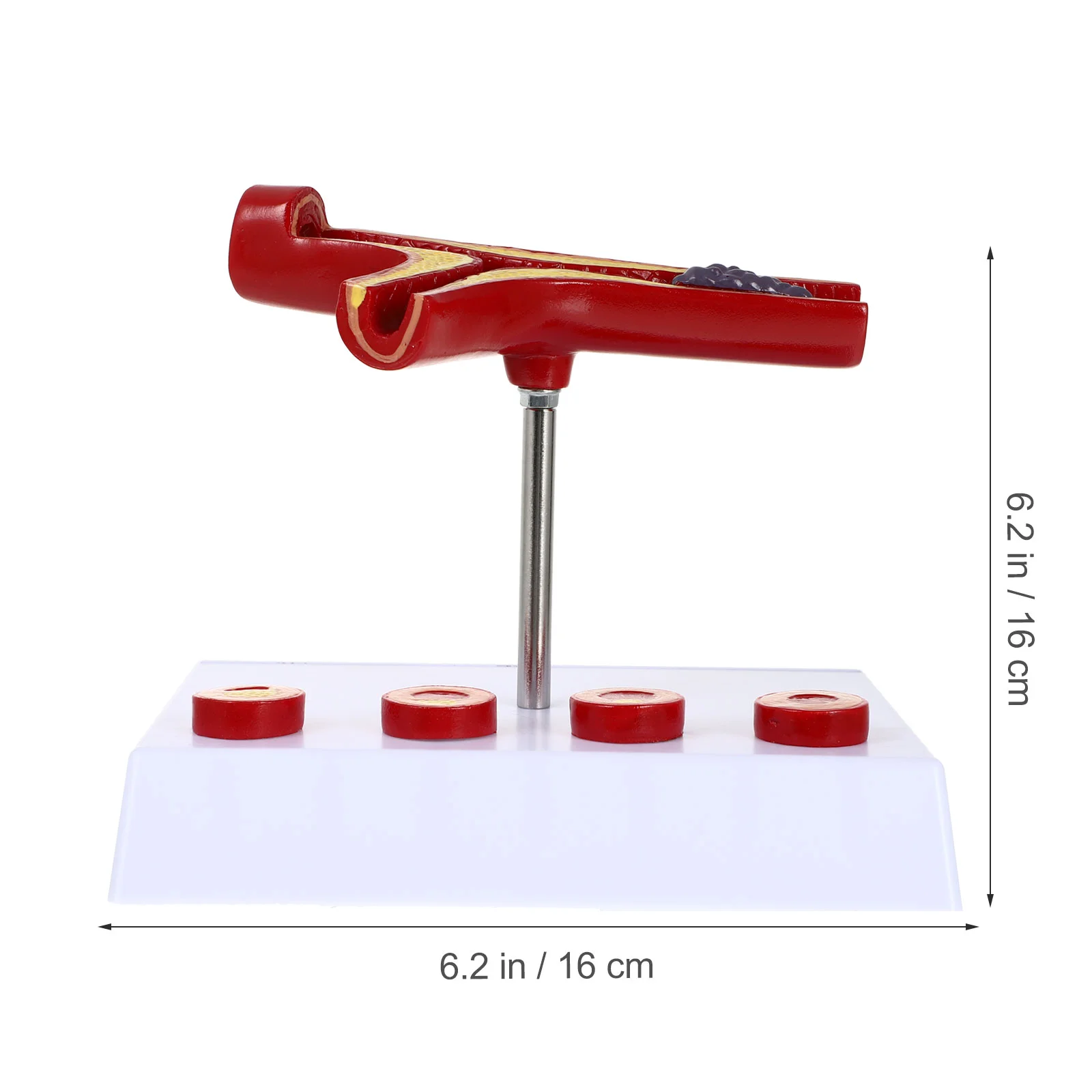 Modelo Vascular, exhibición cardiovascular anatómica de vasos sanguíneos, enseñanza, espectáculo de aterosclerosis médica