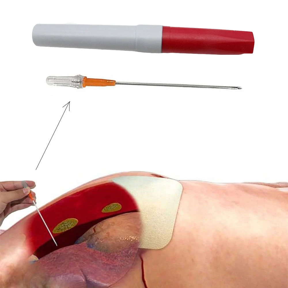 2-10pcs Pneumothorax Needle Trauma Medical Chest Cathether Needle catheter Needle Decompression First Aid Kit