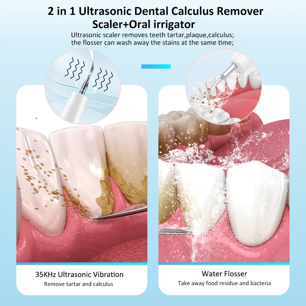 Rimozione del tartaro dentale elettrico ad ultrasuoni Scaler per denti irrigatore idropulsore dente orale rimozione del tartaro detergente per macchie di placca