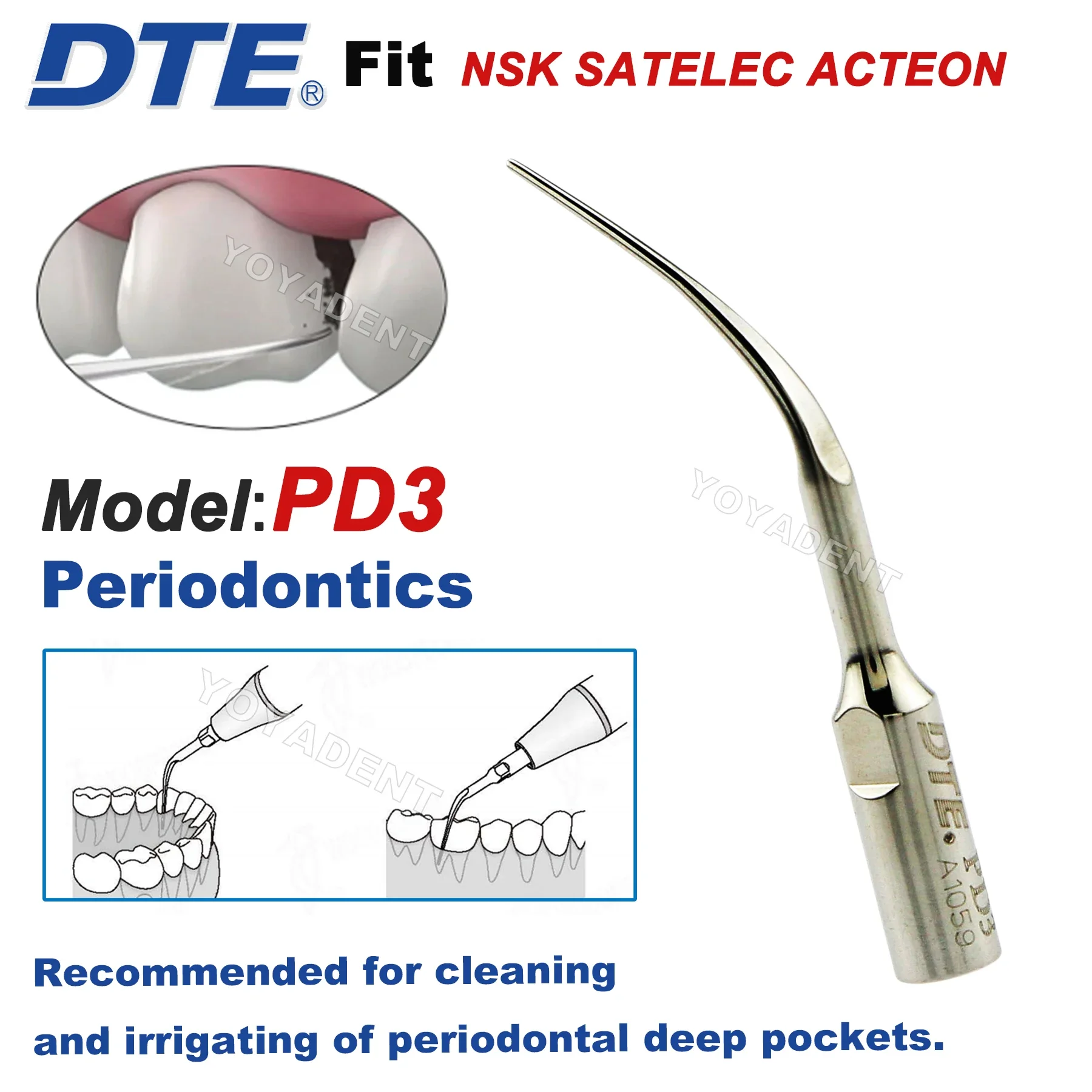 Woodpecker DTE Dental Ultrasonic Scaler Tips Periodontics Scaling Tip PD3 Fit EMS SATELEC NSK Scaler Handpieces