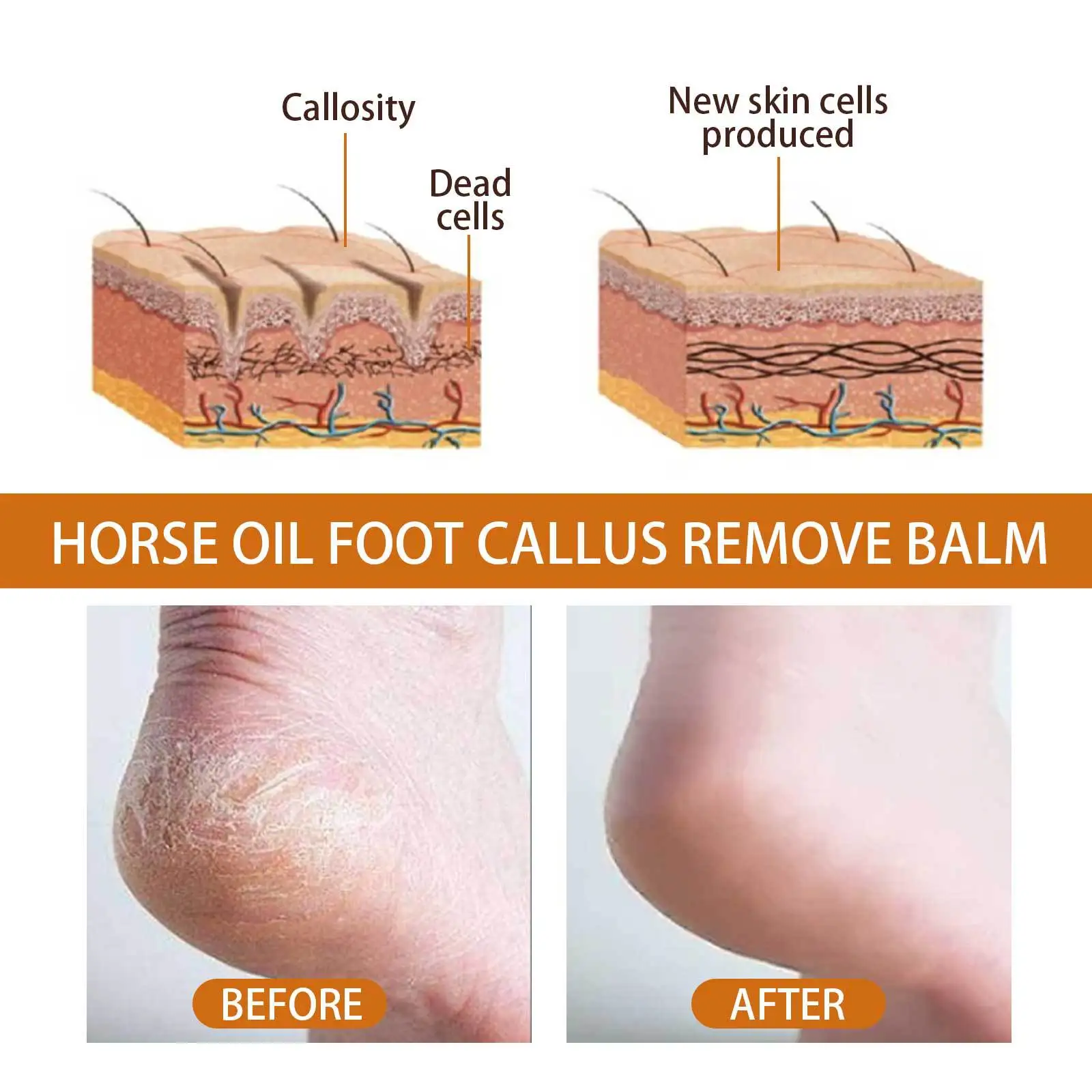 Horse Oil Crack Heel Foot Cream Exfoliating Moisturizing Whitening Nourish Hand Cream Foot Care Foot Callus Dead Skin Remover30g