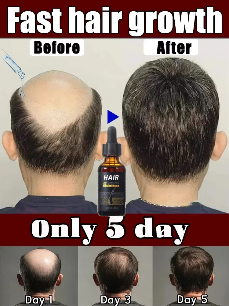 Balding helper, gently fills thin patches and boosts hair volume, say hello to dense, healthy hair