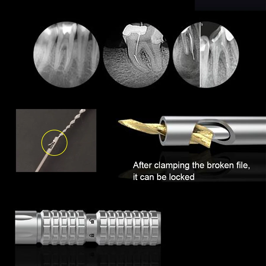 Sprzęt stomatologiczny zestaw do usuwania plików z kanałami korzeniowymi do usuwania uszkodzonych plików do leczenia endodontycznego