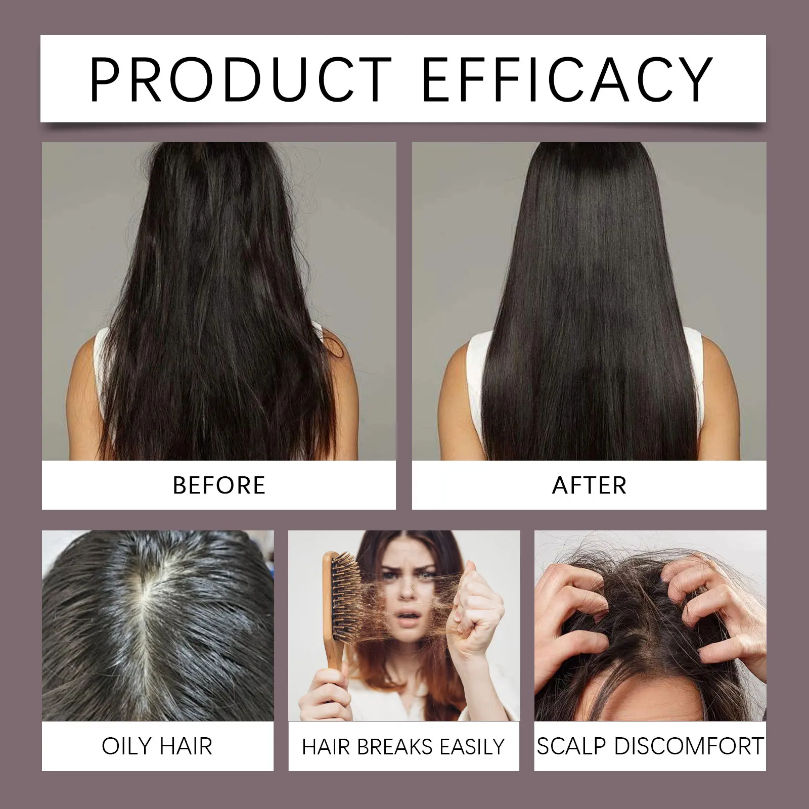 3-in-1 Rode Uien Haarshampoo Kalmerende Hoofdhuid Intense Repair Batana Voedende Shampoo met Rozemarijnextract voor alle haartypes