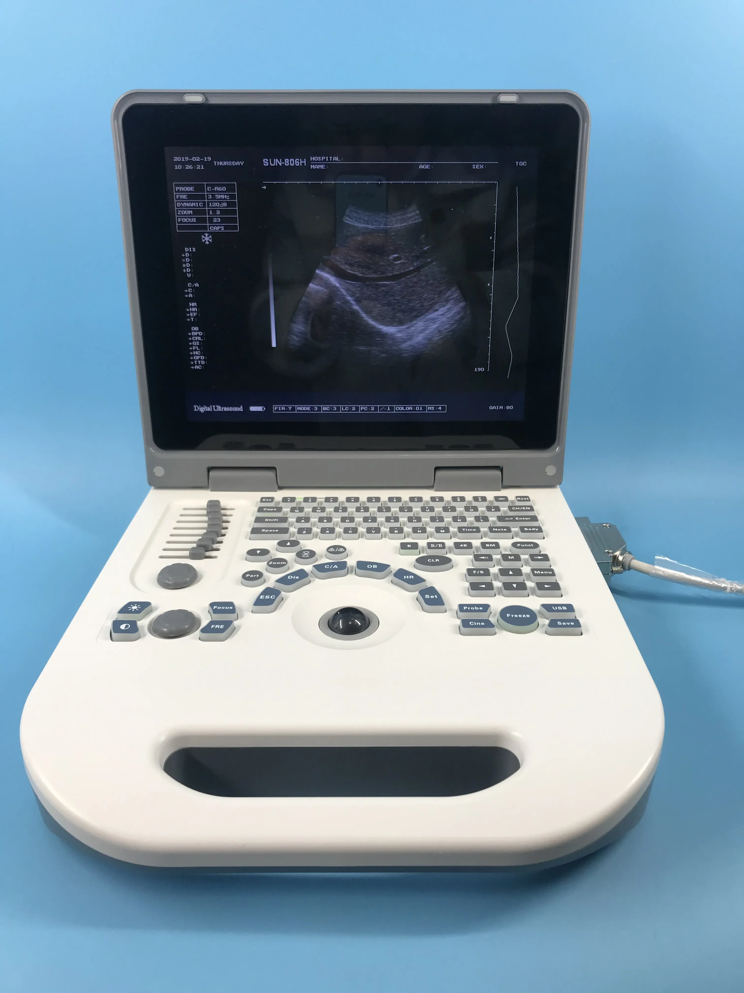 Full Digital Diagnostic Sonography Medical Portable Ultrasound Scanner