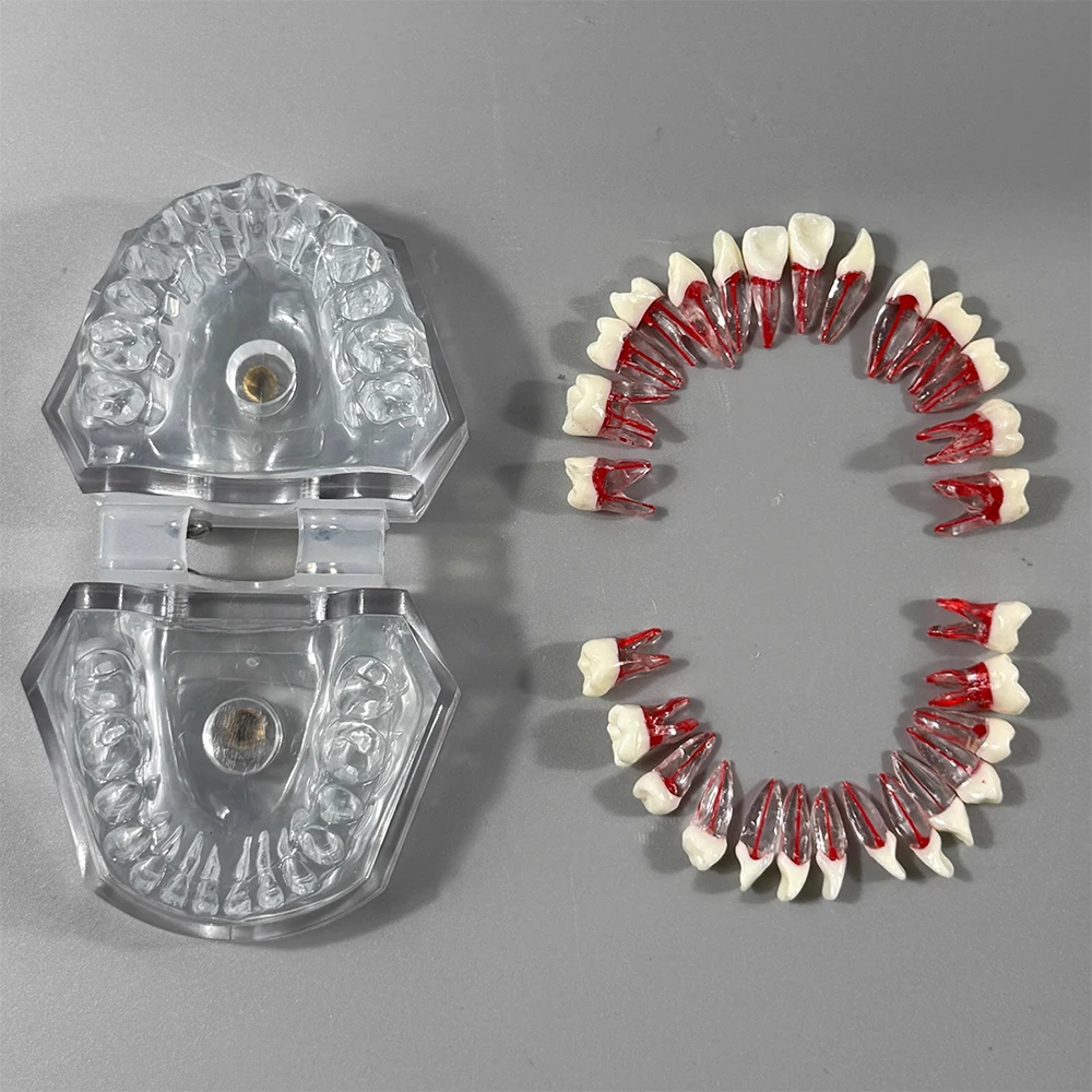 Dental Typodont Model With 28pcs Full Mouth Resin Root Canal Tooth Practice Blocks Model Endo Pulp Cavity Study Teeth Jaw Model