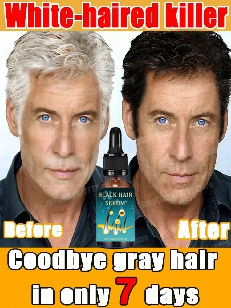 Gray White Hair Serum Liquid White To Black Natural Color Repair turns white into black, and prevents gray Men Women New