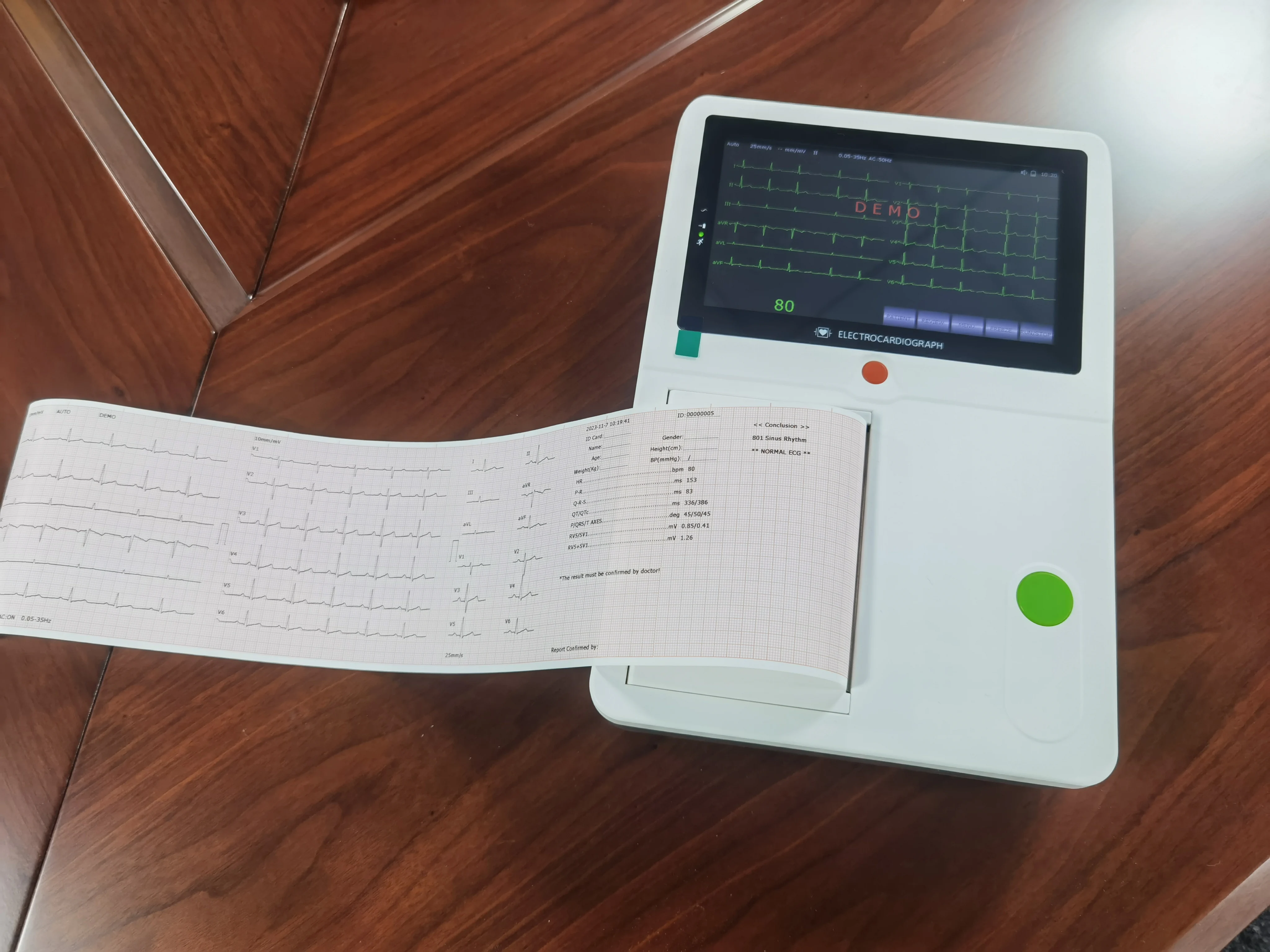 Chenwei Cheap Price 6 Channel EKG Recorder Equipment Portable Mobile 12 Leads 6 Channel Portable Holter Monitor With Battery