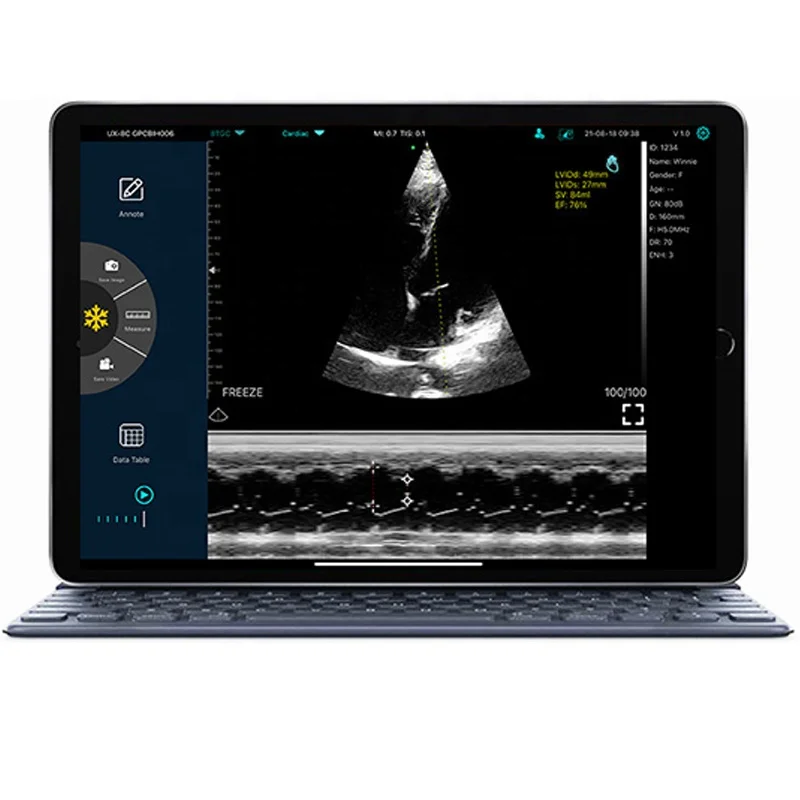 Handheld Wireless Type 4D 3D Ultrasound Doppler Machine