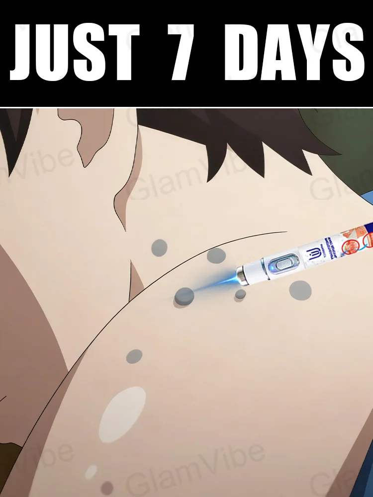 2025 Nuovo aggiornamento Laser blu Risolvi strumento verruca