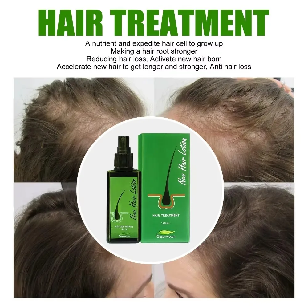 Originale thailandia Neo lozione per capelli paradiso 120ml olio per la crescita dei capelli tonico capillare per la crescita Anti perdita di capelli trattamenti per il cuoio capelluto uomini