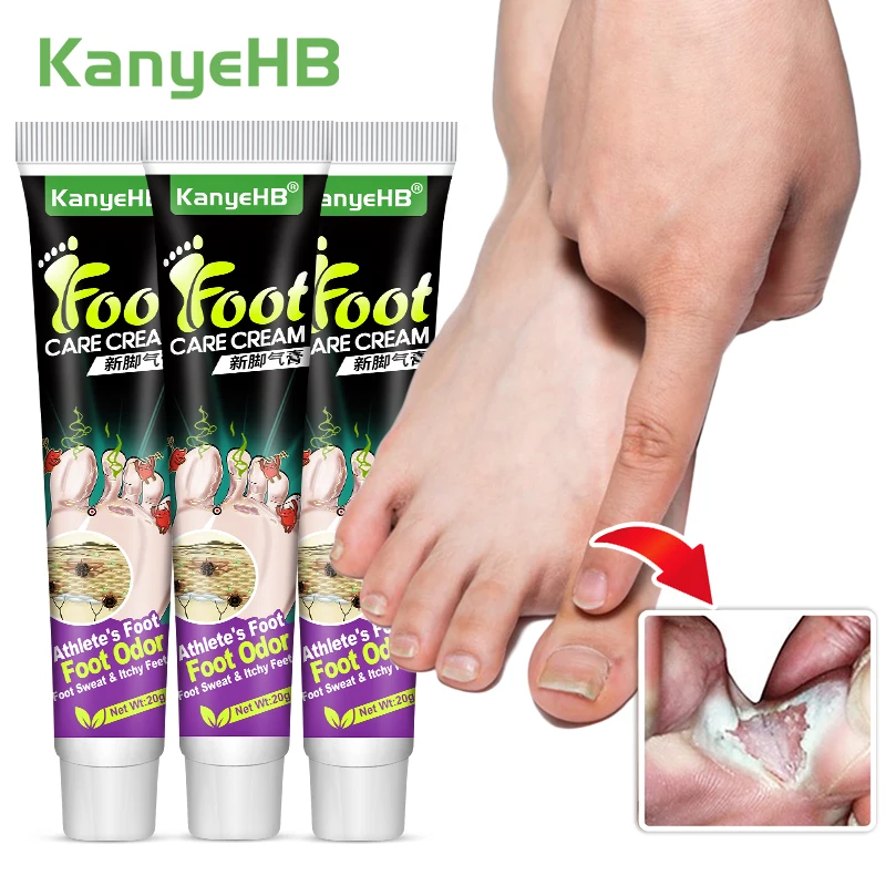 

3pcs Medical Anti-itch Tinea Pedis Cream Foot Psoriasis Cream Eczema Foot Odor Fungal Infection Athlete's Foot Ointment A1284