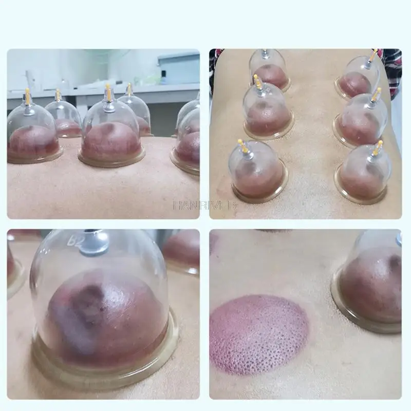 Vacuum Cupping body Massager Suction Cups Jar Set Plastic Vacuum Suction Therapy Cupping Set Cans for Massage