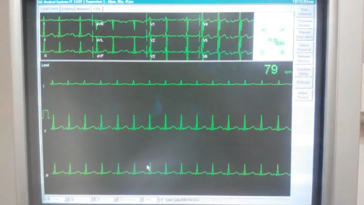 Imagem -03 - Gerador de Simulação de Sinal de Pulso Dg1000 Gerador de Sinal Ecg Gerador de Sinal