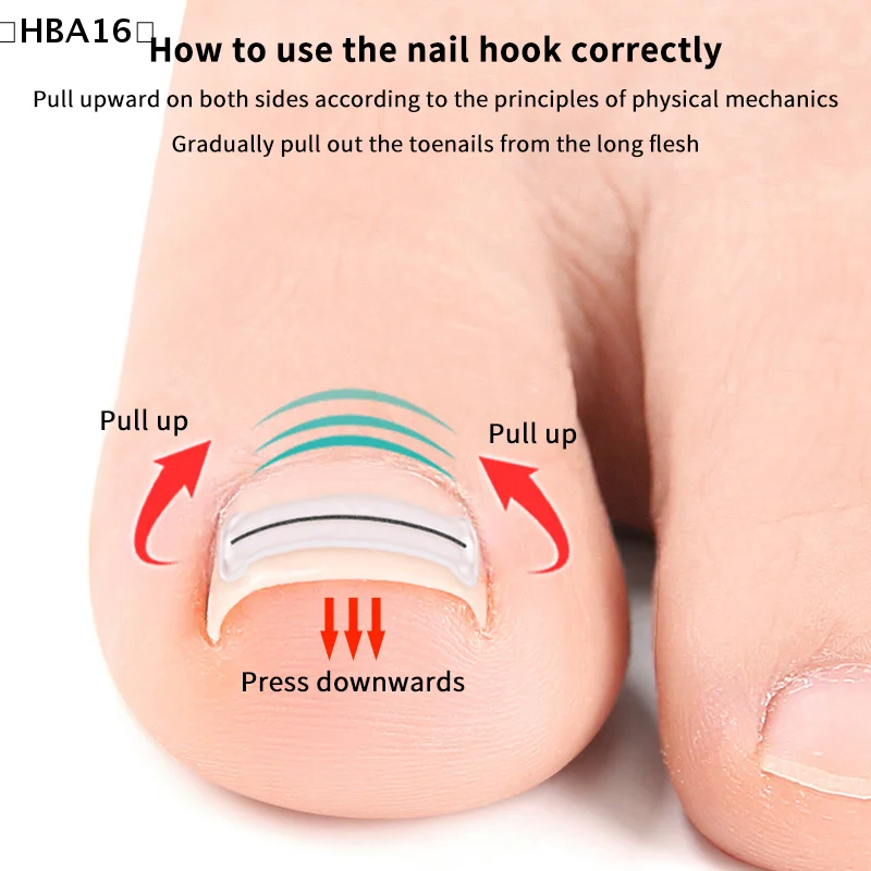 ómHBA16 Parque2 Stuks Nagel Correctie Stickers Ingegroeide Teennagel Corrector Patches Paronychia Behandeling Herstellen Corrector Pedicure Gereedschap