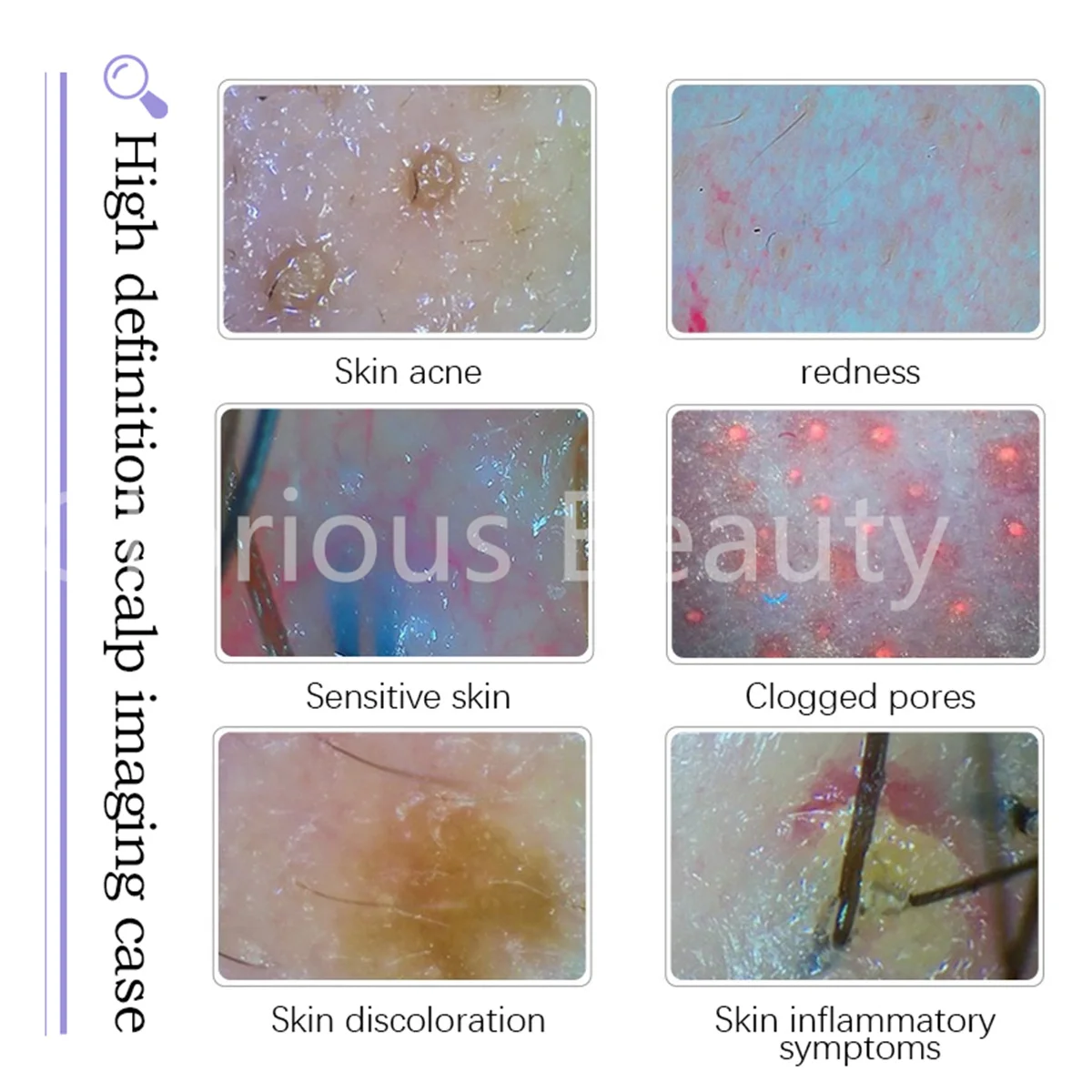 Novo 14 em 1 hidro branqueamento cuidados com a pele anti-envelhecimento máquina de beleza firmando a pele remover cravos poros limpos dispositivo facial machin