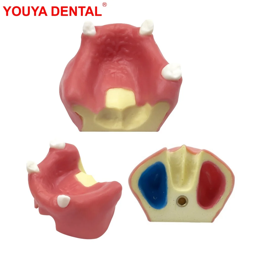 Implant Teeth Model With 3 tooth For Dental Students Training Studying Teaching Demonstration Dentistry Lab Practice Exam Models