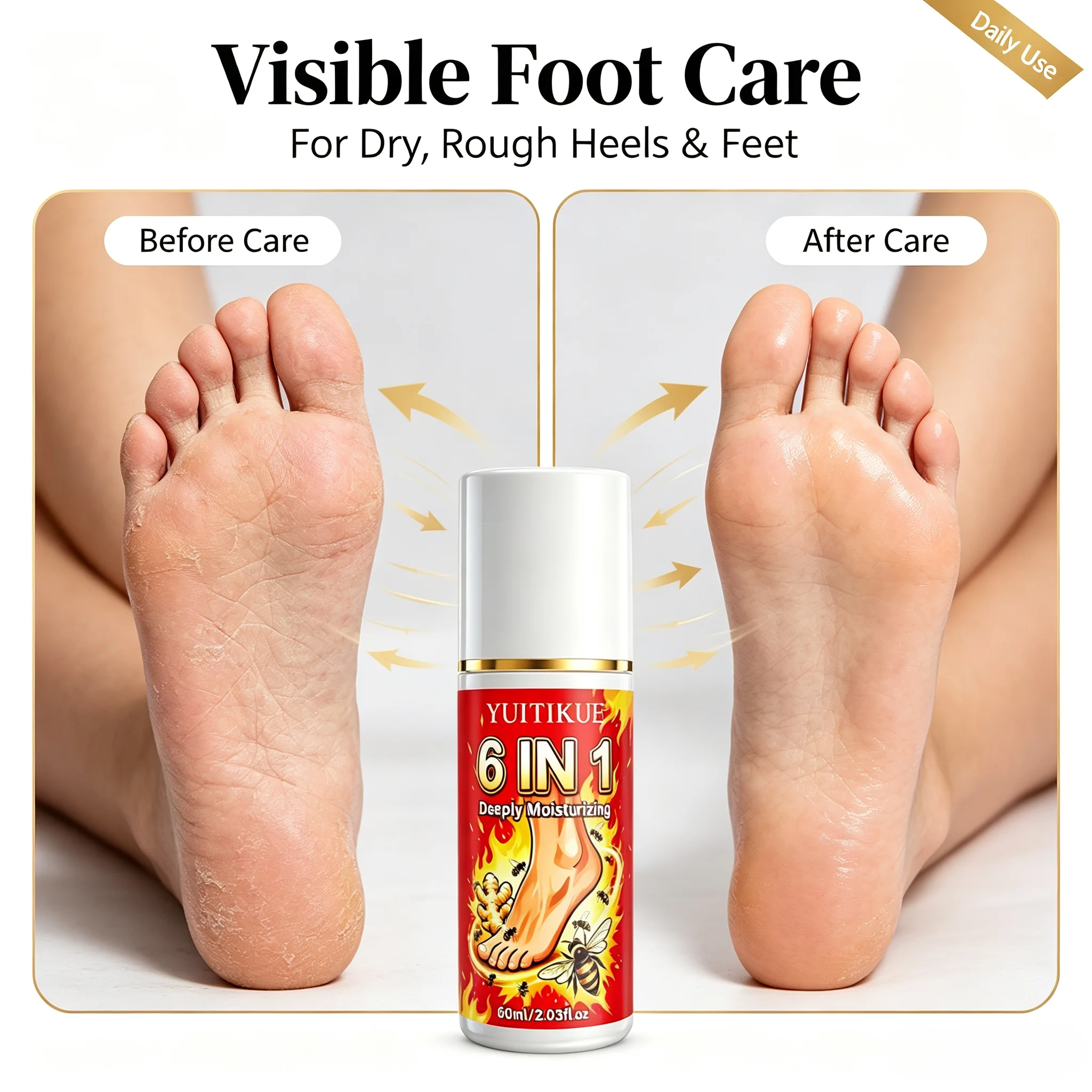 YUITIKUE 6 IN 1 Foot Care Spray Bee Venom Ginger Formula Deeply Moisturizing Foot Skin Hydrating Care Spray 60ml