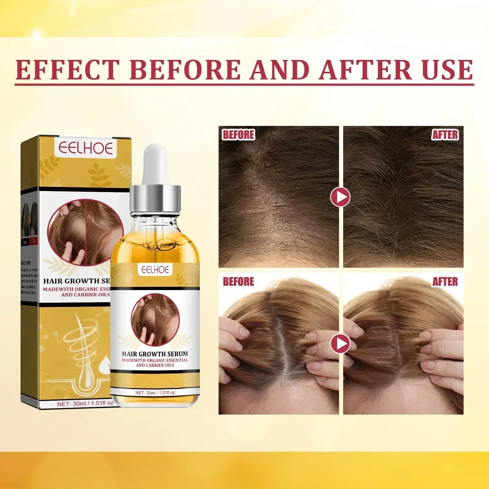 Biotin Fast Hair Growth Oil Regrowth Serum Hair Thinning Treatment Growth Liquid Hair Loss products for Women Men