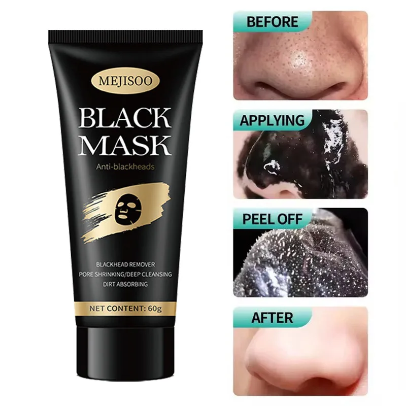 Blackhead Removing Facial Mask Absorbs Acne Black Facial Mask Cleanses Acne Men And Women Moisturize And Apply Facial Mask