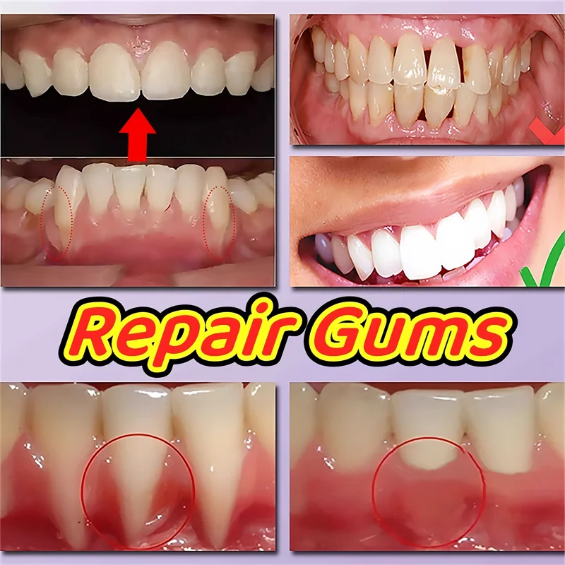 

Rapid Repair Gums Serum Purple Damaged Gum Care Gel Effective Relieve Teeth Allergy Dental Caries Tooth Deep Cleaning Toothpaste