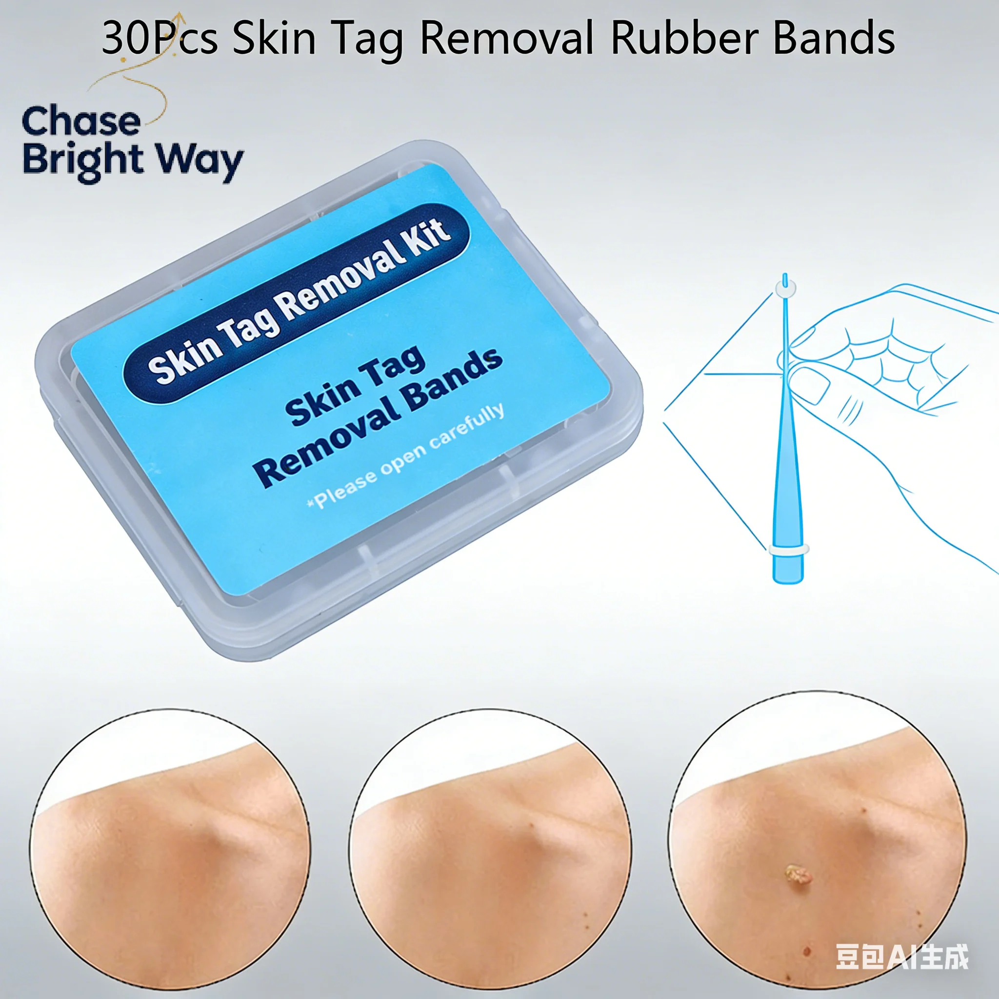 20pcs Skin Tag Removal Rubber Bands Micro Band Non Toxic Face Care Mole Wart Skin Care Tools
