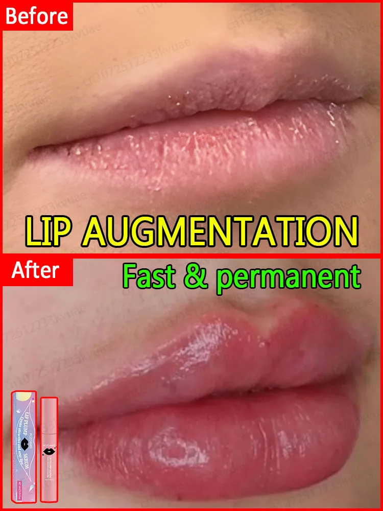 

【2025 New】Volumizing Lip Oil for Luscious Lips | Natural Ingredients, 24H Moisture & Shine