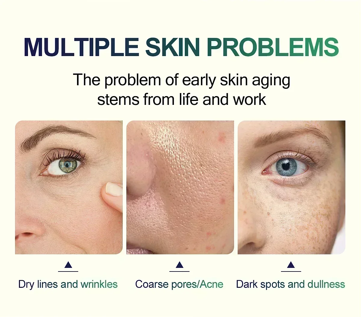 Gele Peeling Olie Bleken Donkere Huidvlekken Verwijderen Dode Huid Lichter Melanine Scrub Exfoliërende Witheid Hydrateren Gezichtsverzorging