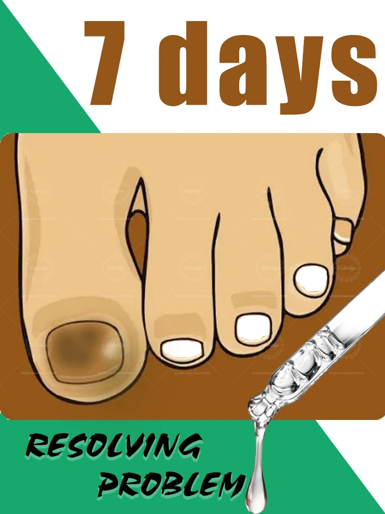 

Generation-2 Foot Care Tools Cleaning Nail Say Goodbye To Bad Nail In 7 Days
