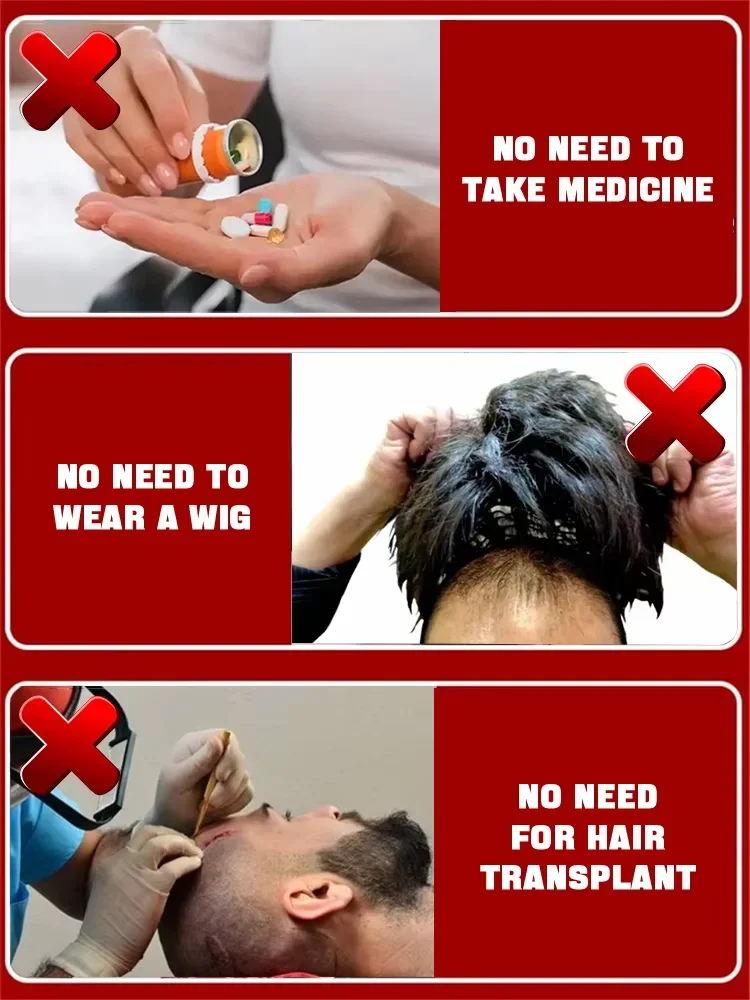 Hot selling hair growth products, fast, help, hair, grow. Fix hair loss, fix baldness.