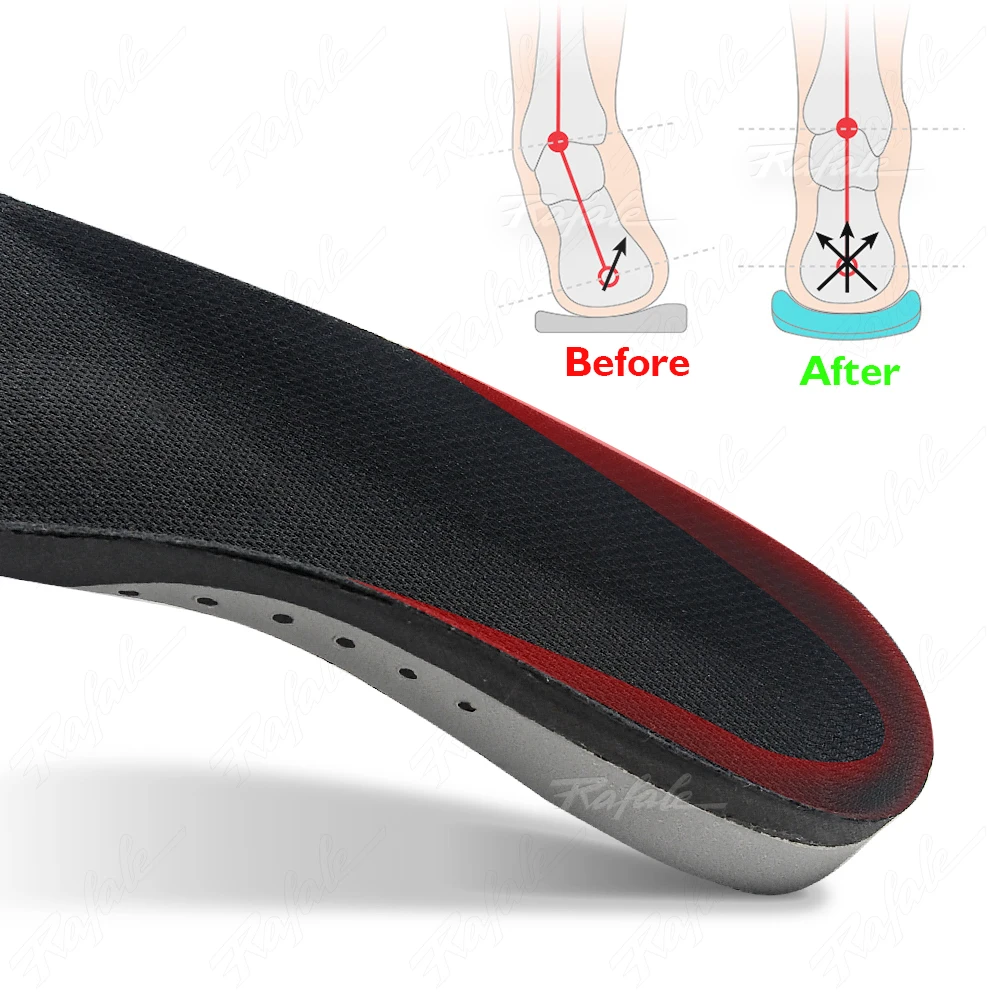 Flat Feet Template Arch Support Orthopedic Insoles,plantar Fasciitis Heel Pain Orthotics Insoles Sneakers Shoe Inserts Men Women