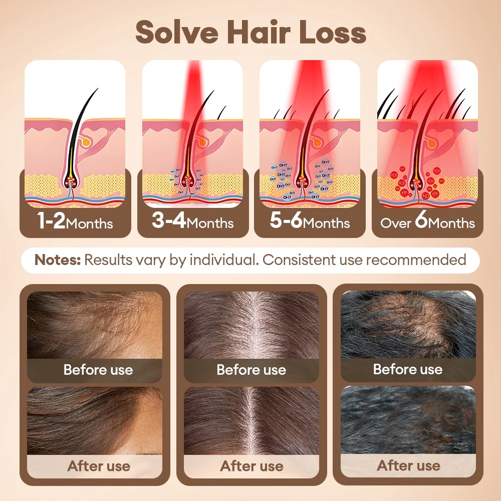 Thumbnail 4 - #8 Compare Hair Loss Treatments Before You Buy