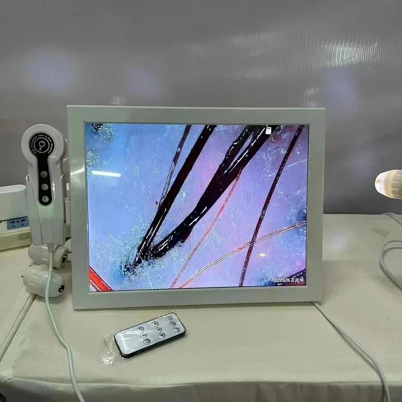 2025 HD Digital Skin Analyzer Professional Hair Scalp Camera Detector Hair Follicle Oil Moisture Test Device 15inch