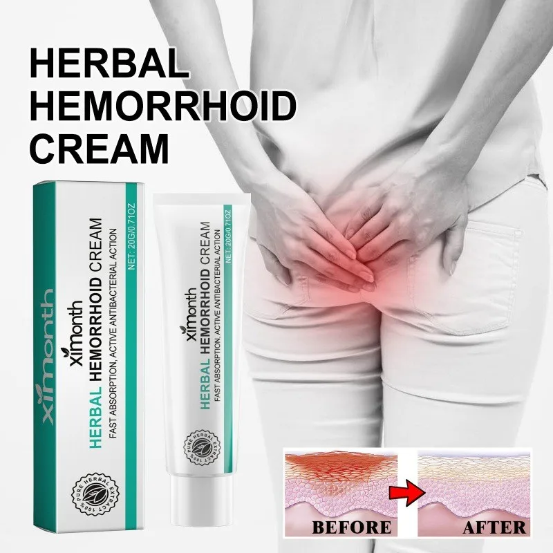 20ML Herbal Hemorrhoid Relieves Anal Itching Eliminates Hemorrhoids Eliminates Meat Balls Body Care Hemorrhoid Care 2024