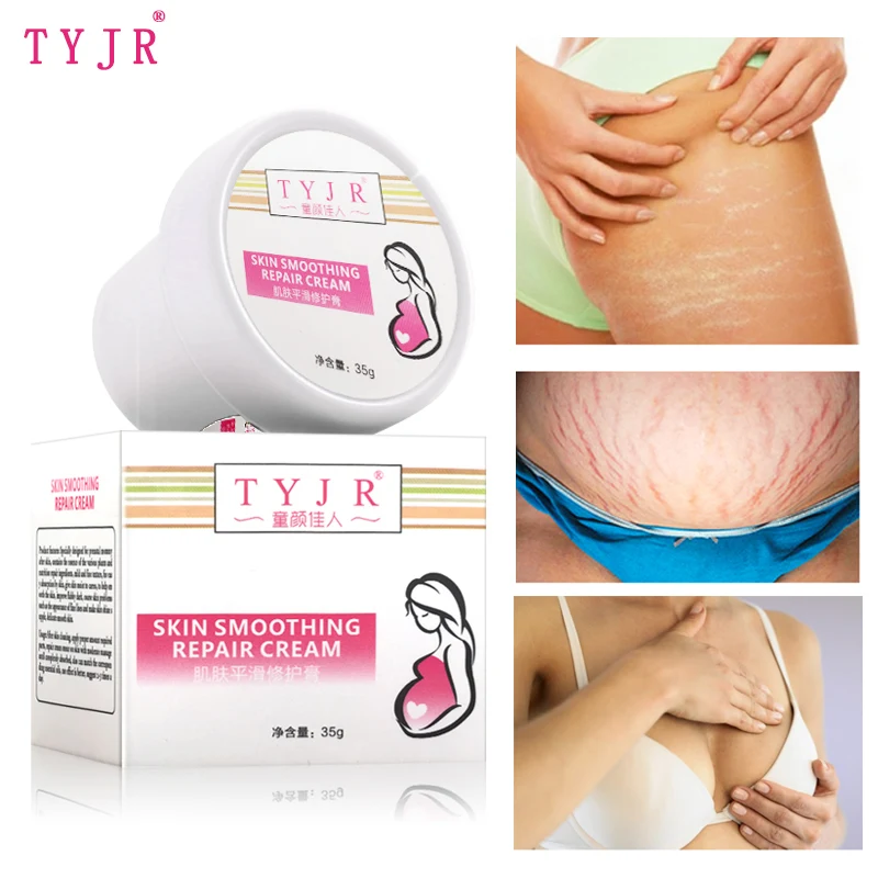 35G Effectively Repair Stretch Marks Removal Remover Plant Natural Heal Pregnancy Breast Hip Legs Stretch Mark Cream