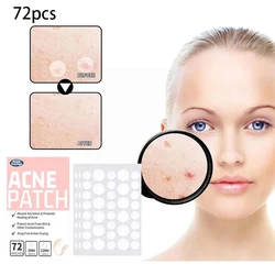 Patchs anti-acné invisibles, élimination des boutons, anti-acnés, patchs hydrocolloïdes, taches, marques, correcteur, réparation, autocollant, boîte étanche, 72 pièces