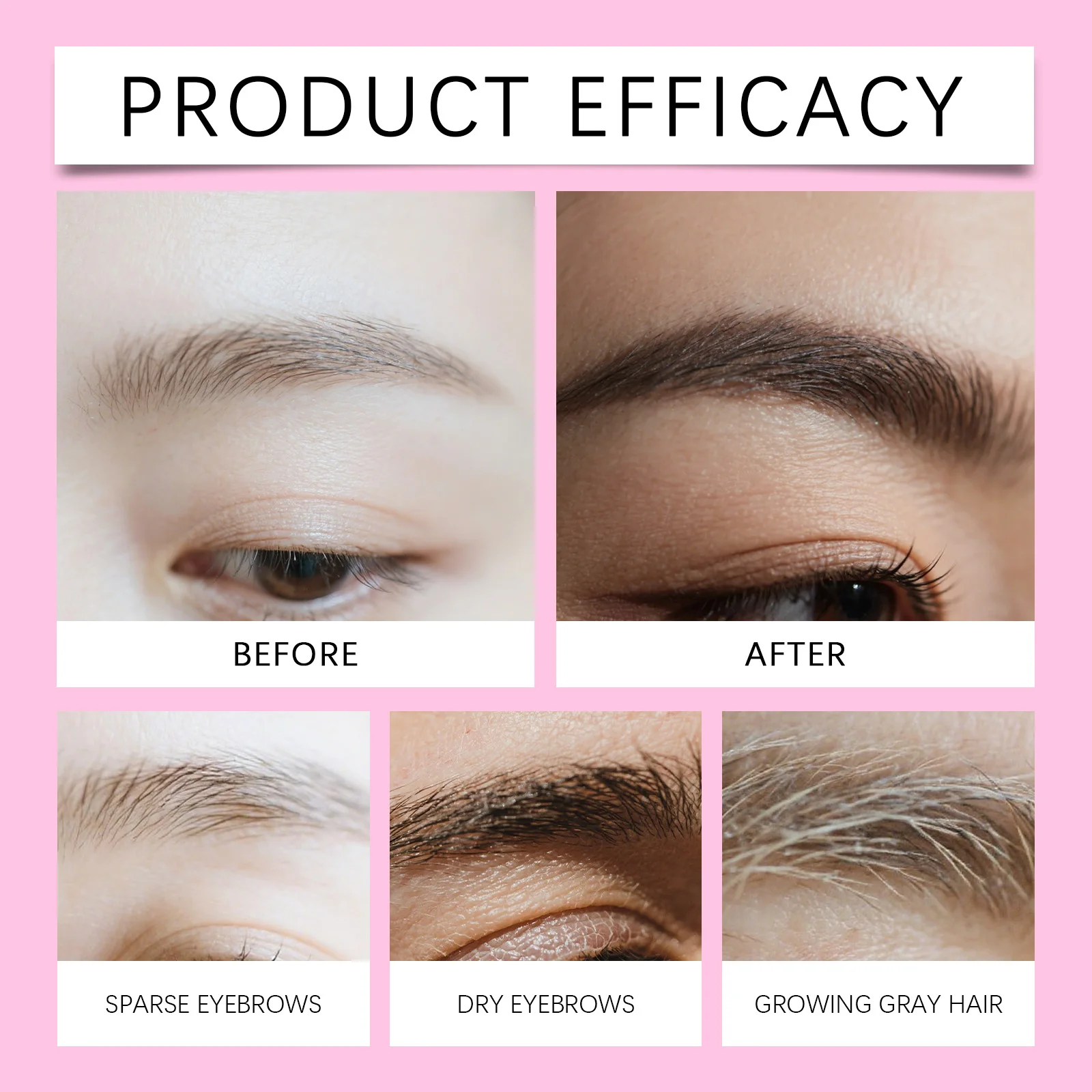 Eyebrow Care Serum Fast Eyebrow Growth Serum Eyelash Hair Growth Anti Hairs Loss Prevent Baldness Fuller Thicker Lengthening