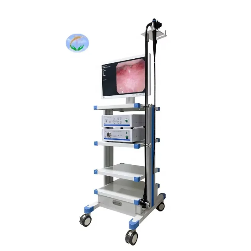 Medical Endoscope  Video Gastroscope and Colonoscope CMOS HD ENT Endoscope  Ear Nasal endoscope usb otoscope