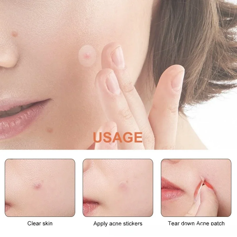 Invisible Acne Remendos Remoção, Espinha, Anti-Acne, Hidrocolóide Patches, Manchas Marcas, Corretivo, Reparação Adesivo, Impermeável