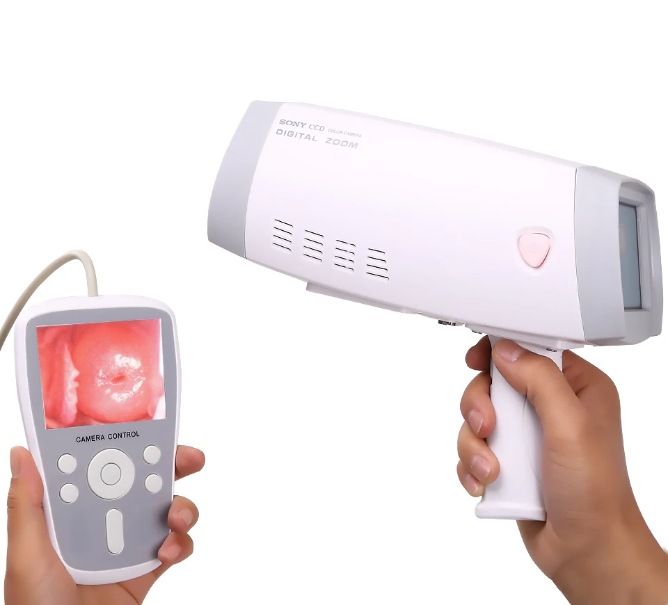 

Portable Handheld Gynecology Colpos-copy system digital electronic video colpo-scope for women colpo-scope for gynecology