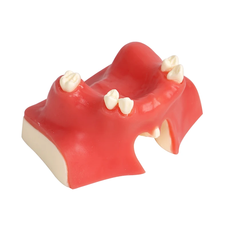 Dental Model Teeth Implant Maxillary Mandibular Sinus Practice Teeth Model Implants Dentist Practice Studying Tools