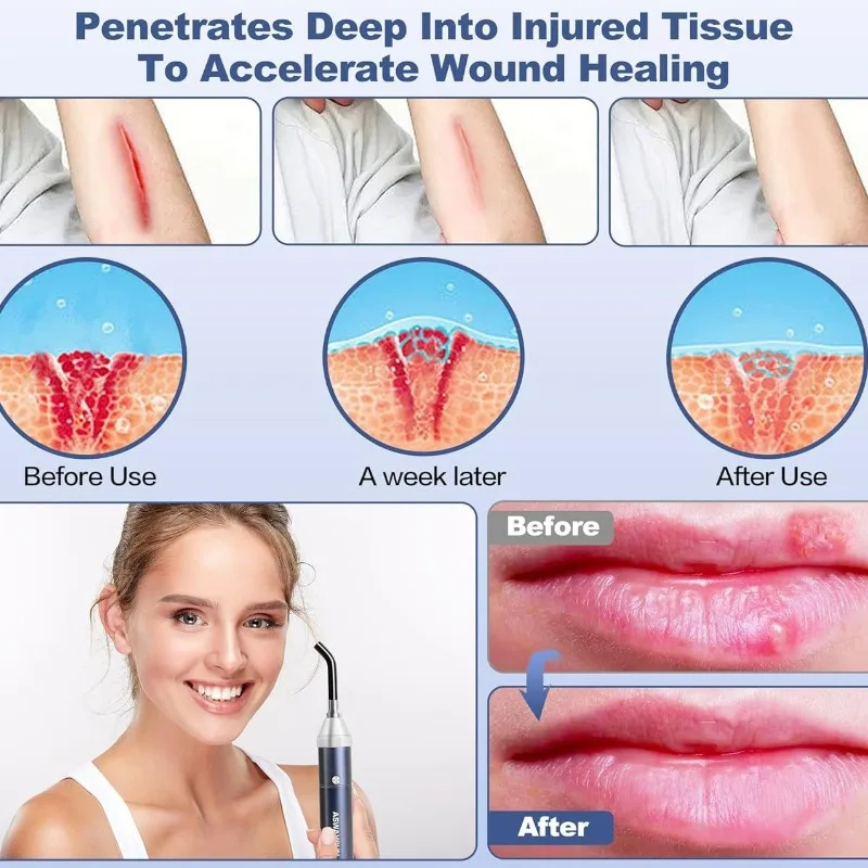 الضوء الأحمر مصباح يدوي دليل العمود الأشعة تحت الحمراء فحص الفم LED معدات الإضاءة 850nm باليد العلاج الطبيعي المساعد