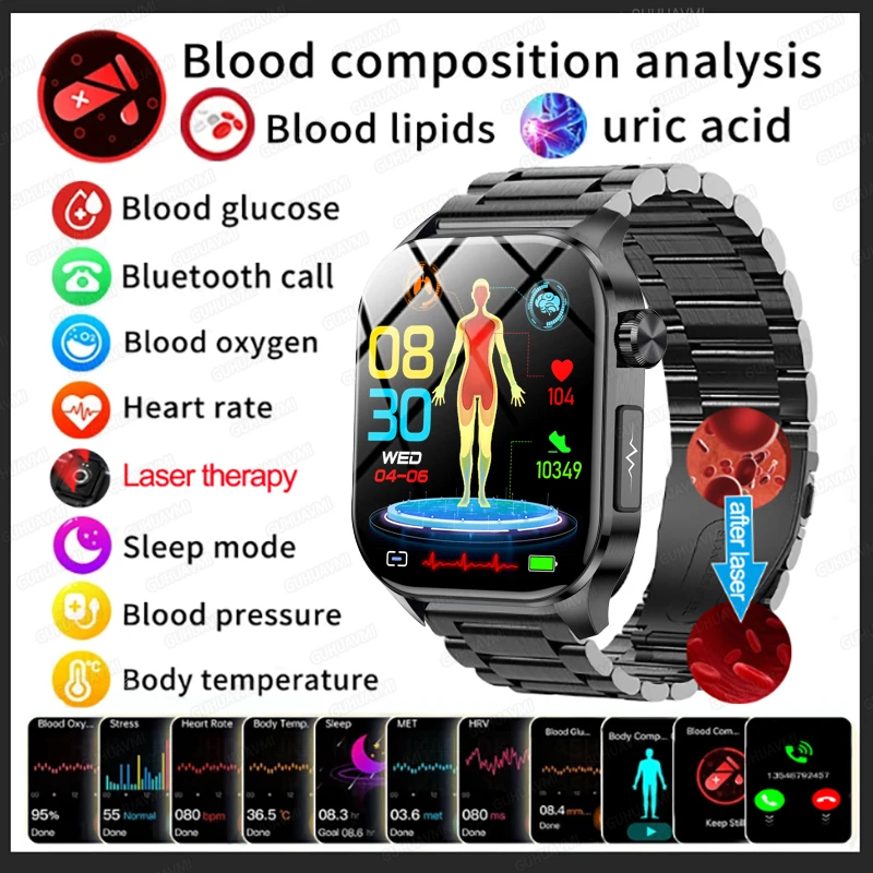 Männer 1,5-Zoll-Amoled-Gesundheit Smartwatch Blut Körper zusammensetzung Messung ai intelligente Diagnose Lipiden Harnsäure Smartwatch