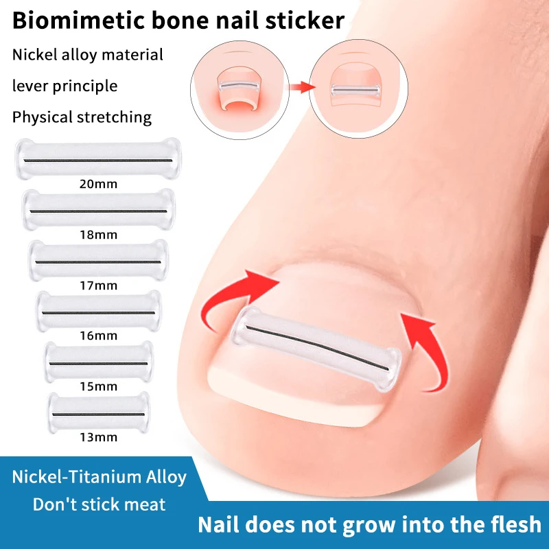 Autocollants correcteurs d'ongles incarnés, 2 pièces, patchs de traitement Paronychia, correcteur de récupération, outils de pédicure, soins des pieds