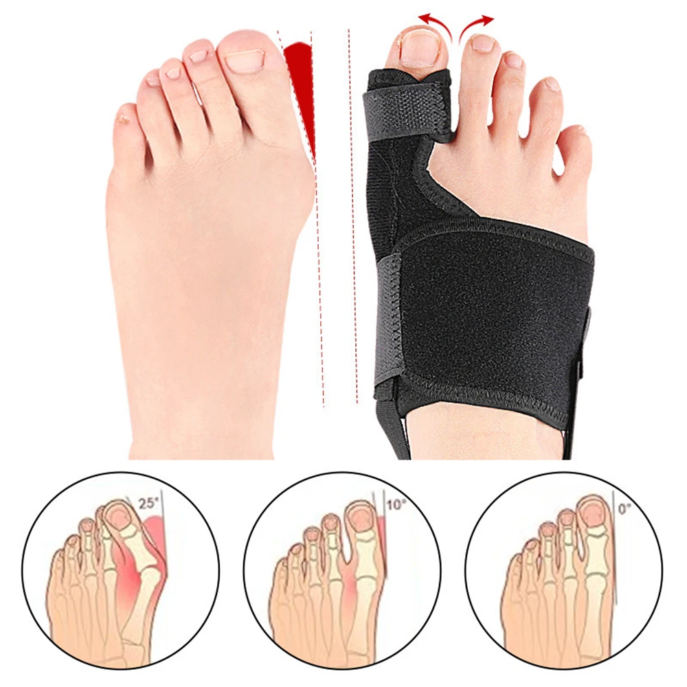 Teen Corrector Orthesen Bone Duim Richter Hamer Protector Hallux Valgus Corrector Bunion Corrector Orthopedisch Gereedschap Care Tools
