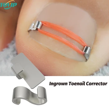 Ingrown Toenail Corrector Pedicure, Incorporar Toe Nail Treatment, Patch profissional de correção do pé, Sticker Care Tool